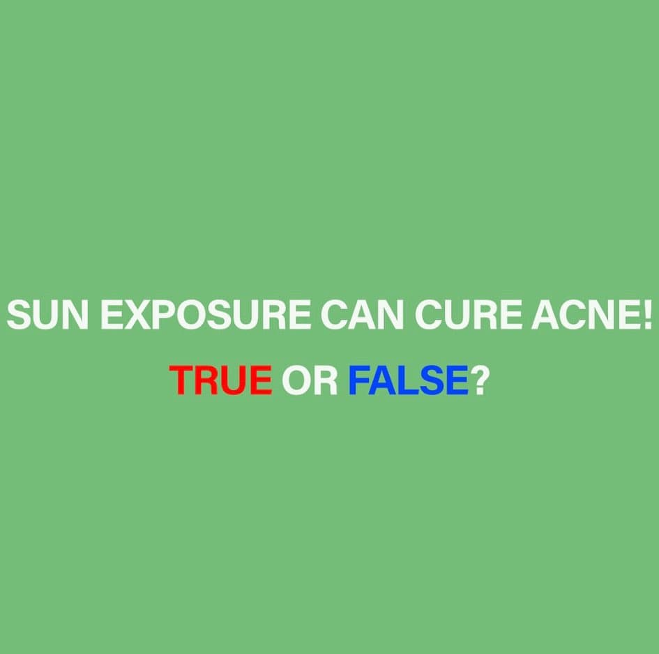 Acne and Sun Exposure: What You Need to Know 2