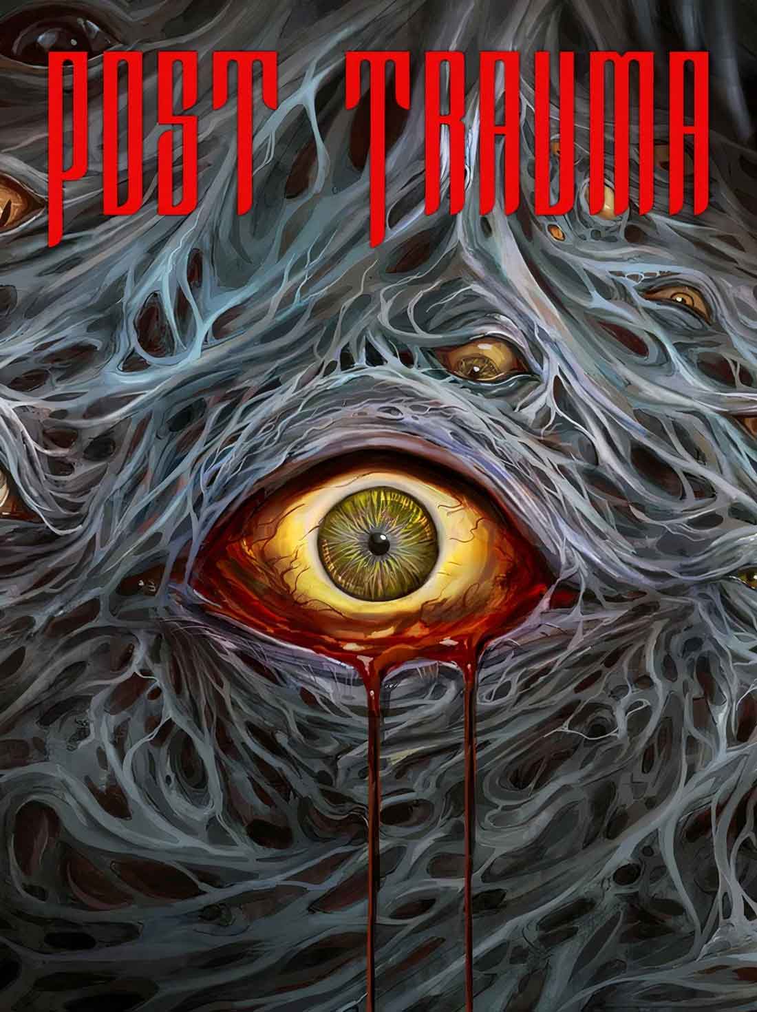 Post Trauma | Steam