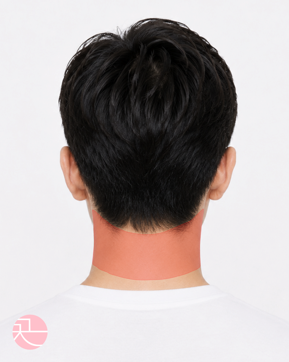 1 제모부위표기_앞턱