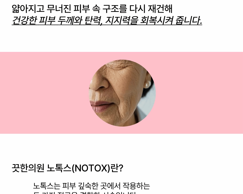 [근본적 주름개선] 턱 · 이마 · 미간 · 팔자 주름엔 노톡스