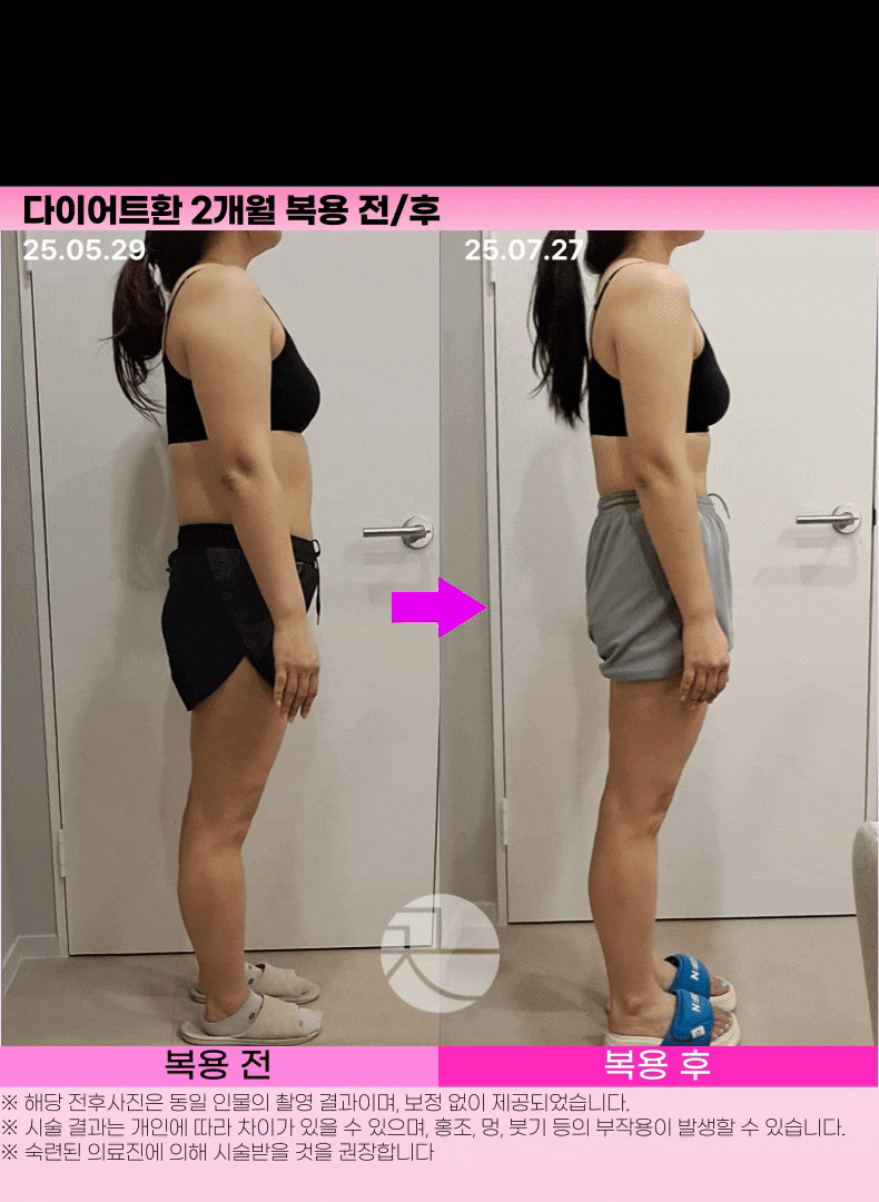 [쎈 다이어트] 쓴 다이어트 환 상세 이미지