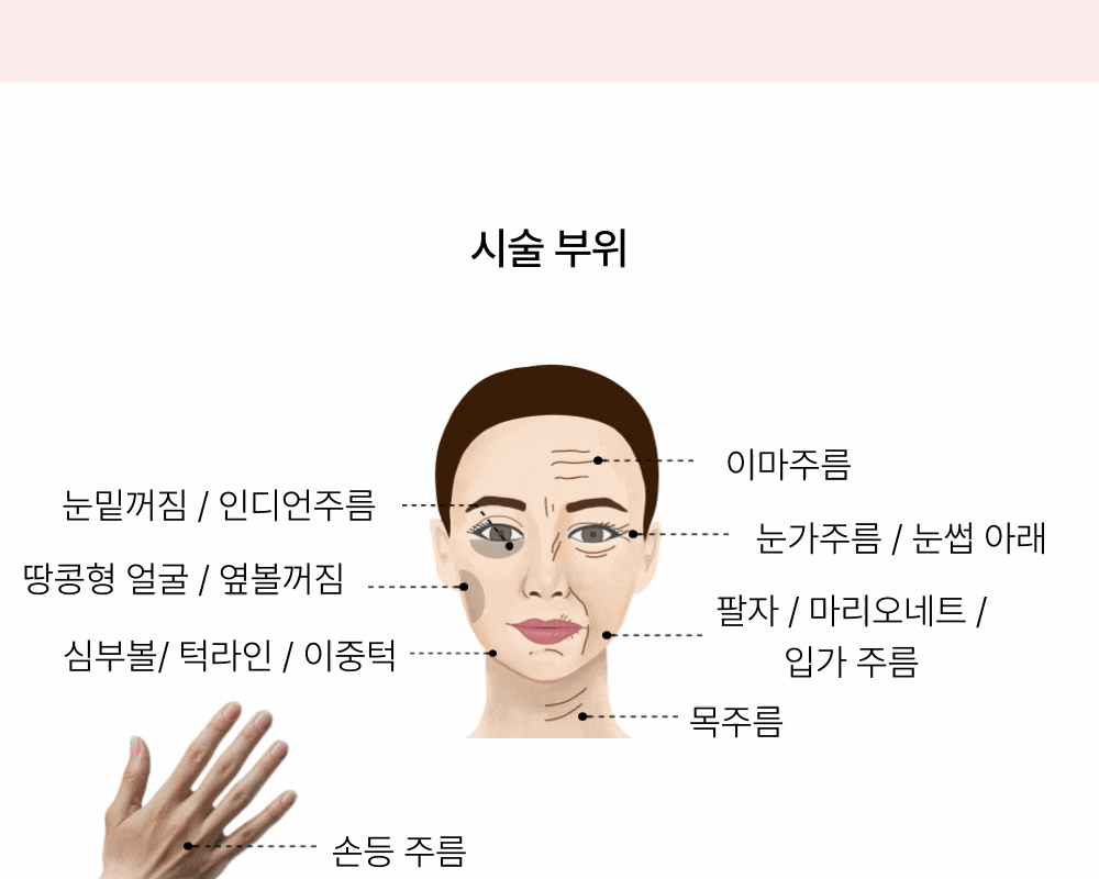 [잔주름,탄력,모공] 텐써마 리프팅 상세 이미지