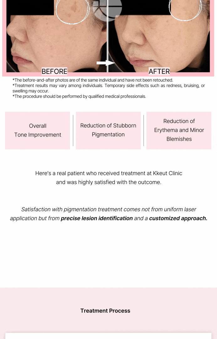 Dual Toning [Personalized Results] 상세 이미지