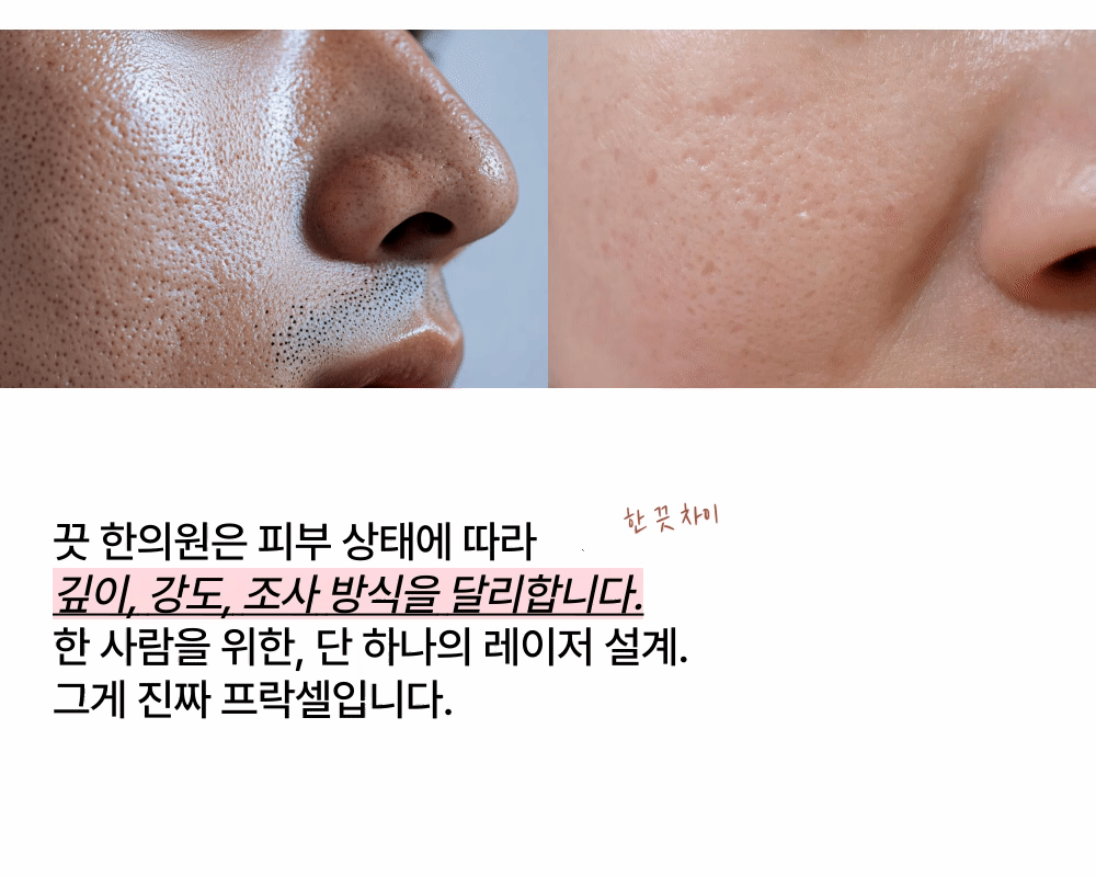 [회복이 더 빠른]  어븀 프락셀 상세 이미지