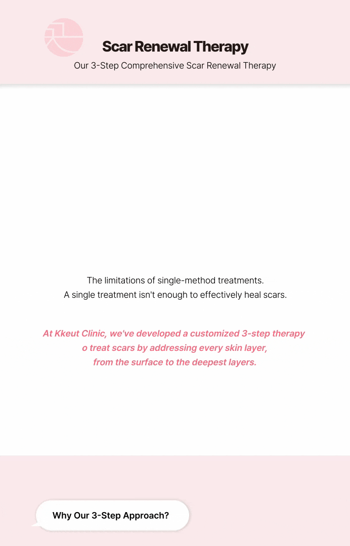Scar Regeneration Acupuncture (Saesalchim) [to fill depressed scars] 상세 이미지