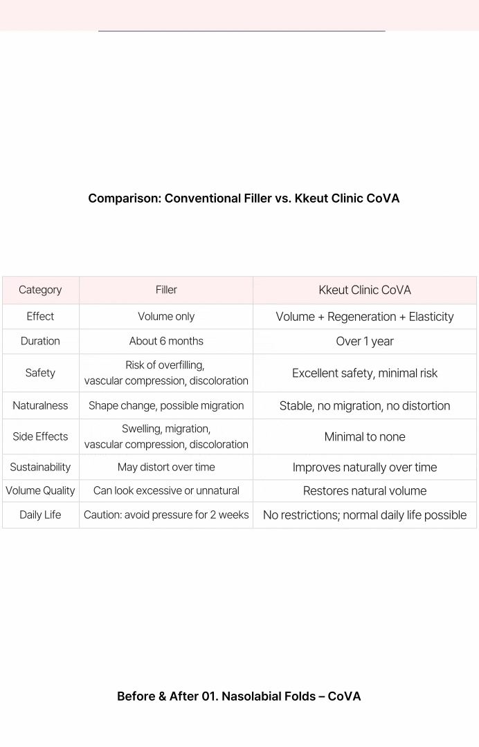 シワフィラー不要！おでこのシワにコラーゲンボリュームニードル COVA 상세 이미지
