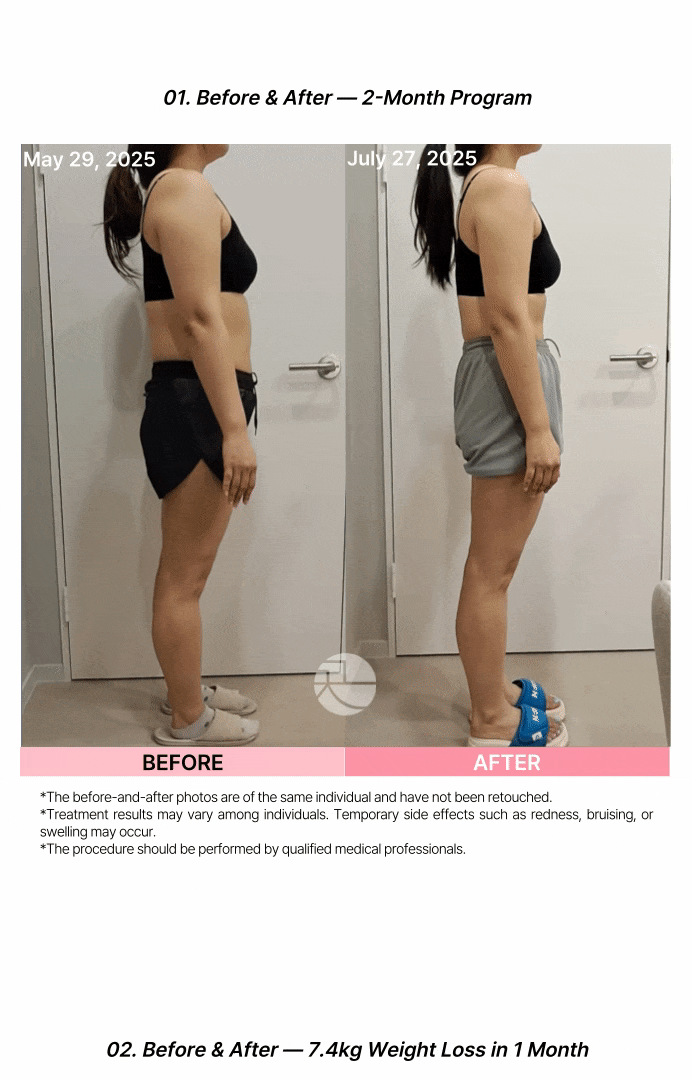 [ダイエット韓方薬] 即効性のクッチャン減肥丸 상세 이미지