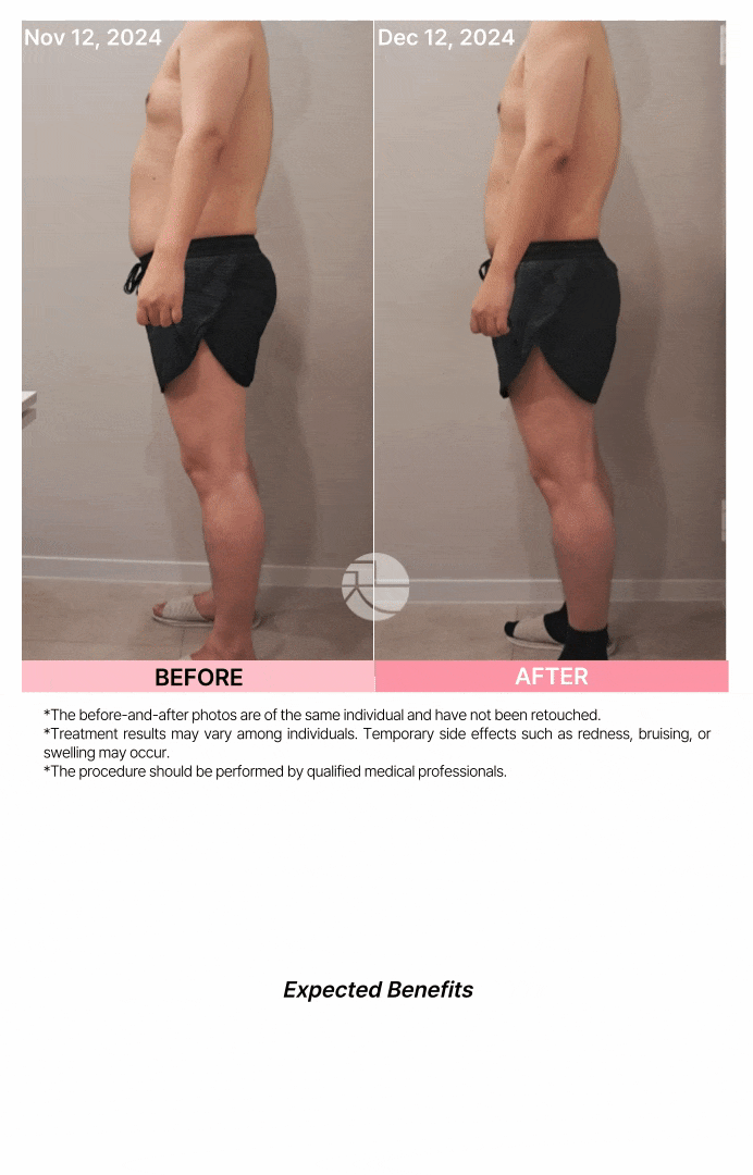 【系统性管理方案】FIT减肥项目 상세 이미지