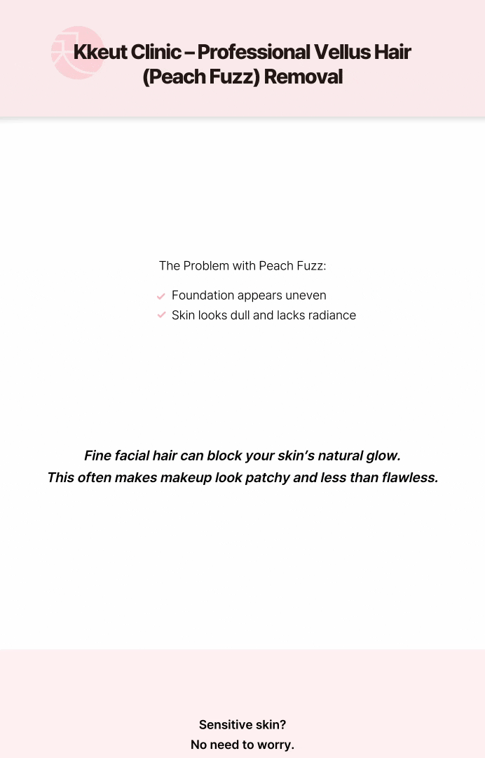 [妆容服帖水光肌护理] 面部绒毛激光脱毛 상세 이미지