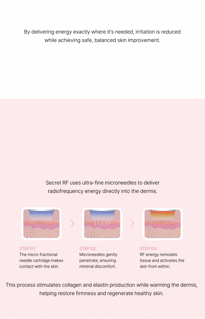 【针对毛孔、痘疤、细纹】Secret RF射频治疗 상세 이미지