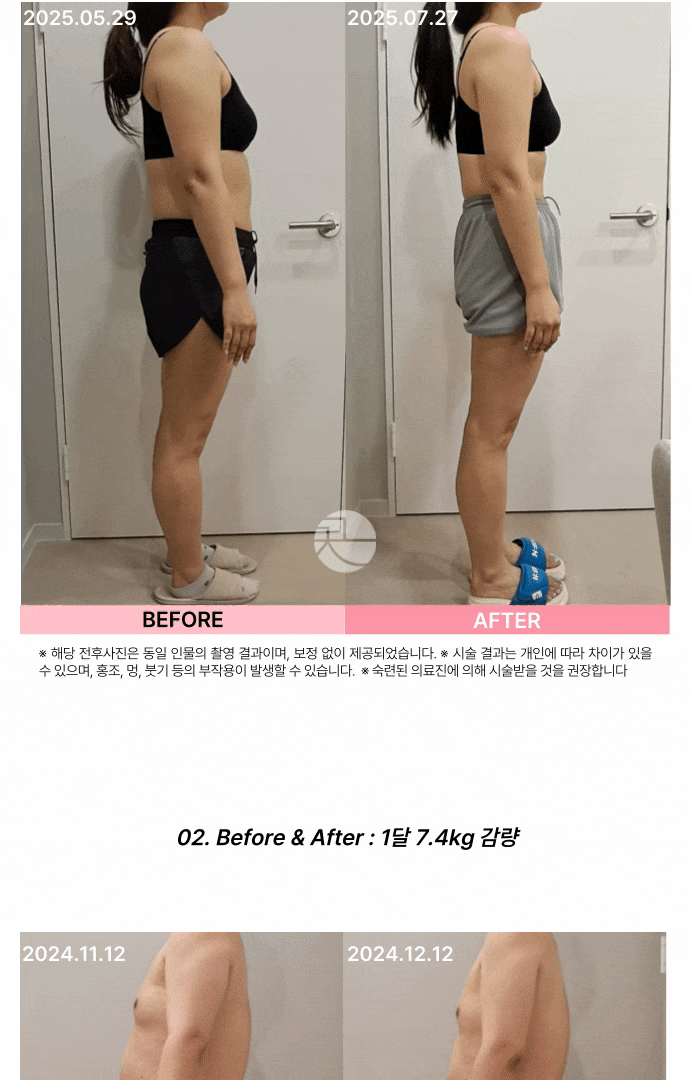 다이어트-통합_복사본.gif