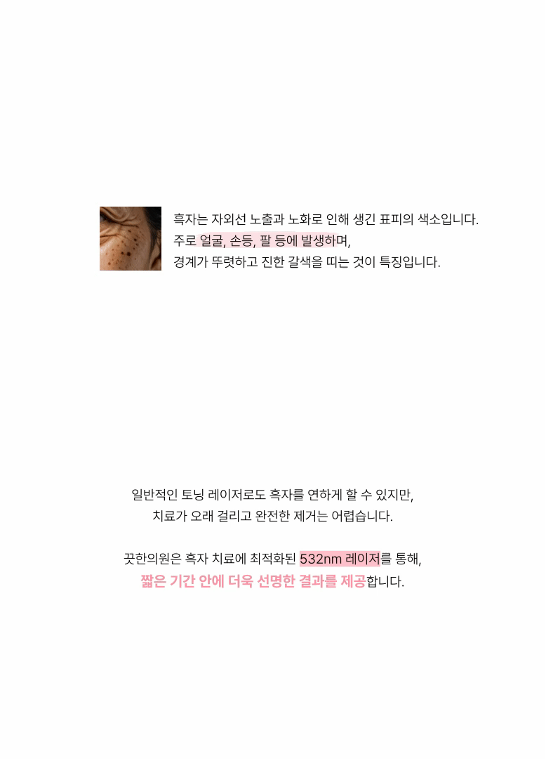 [흑자 쏙 빼는] 흑자 레이저 상세 이미지