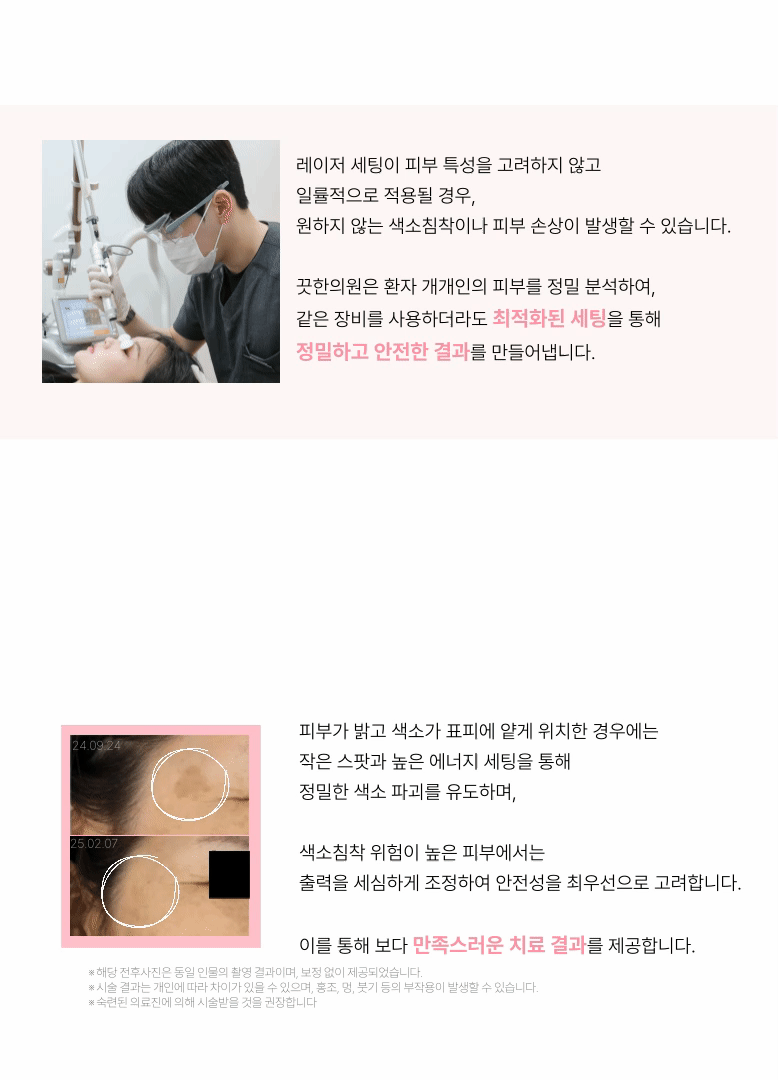 [흑자 쏙 빼는] 흑자 레이저 상세 이미지