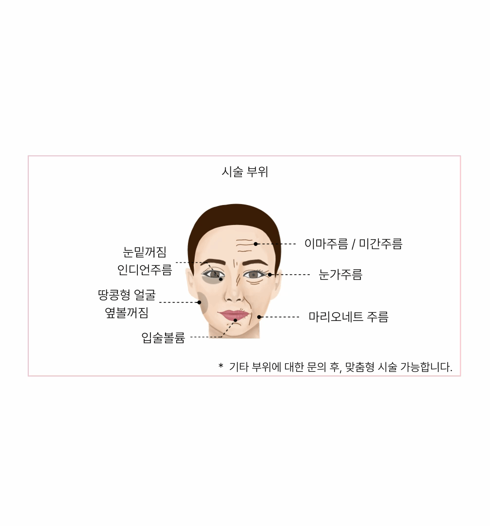 눈밑필러no! - 눈밑꺼짐 콜라겐볼륨침 COVA 상세 이미지