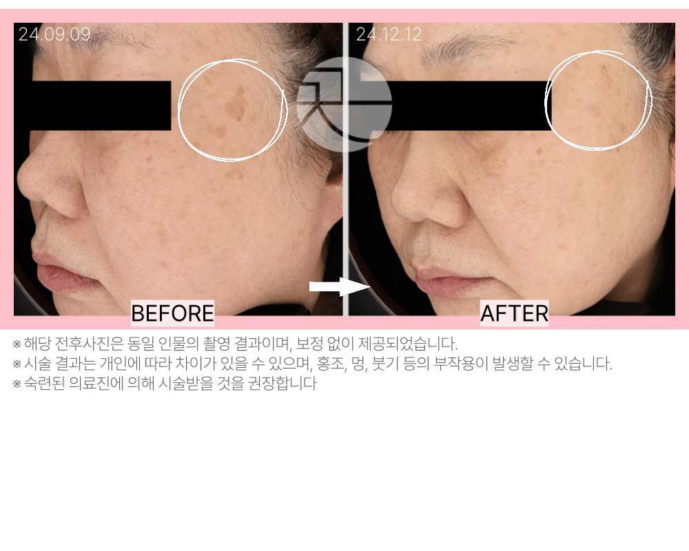  [결과가 같지 않은] 제네시스 토닝 상세 이미지