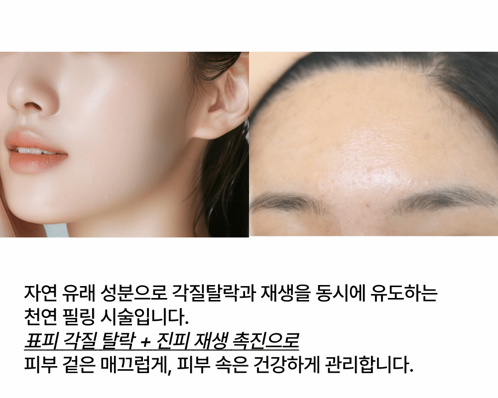 [고운 입자로 모공각화증 케어] 뉴알라딘필 상세 이미지