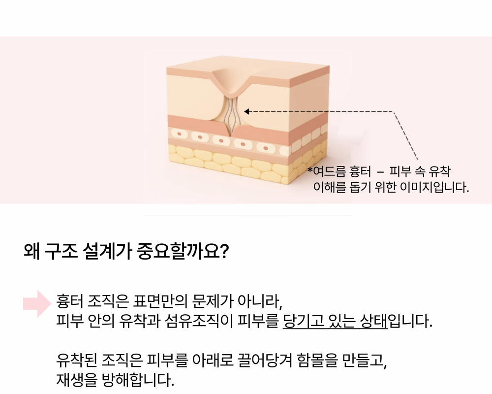 겉은 매끈하게, 속은 단단하게! 피부 리셋 상세 이미지