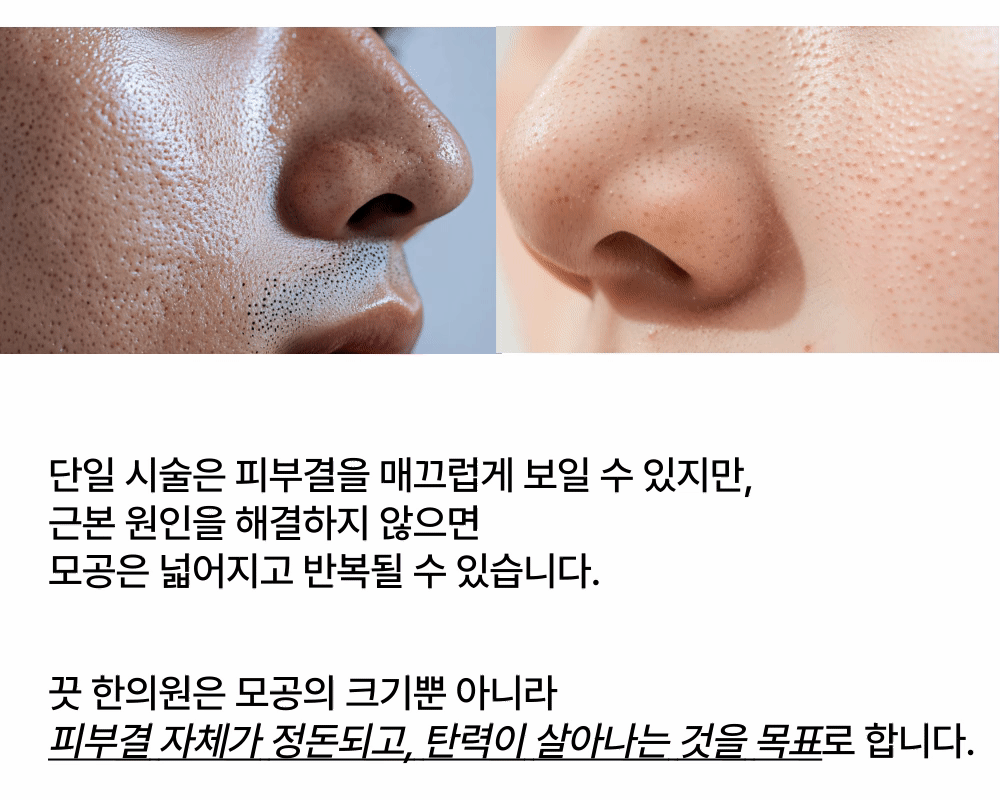 모공 복합시술 패키지 상세 이미지