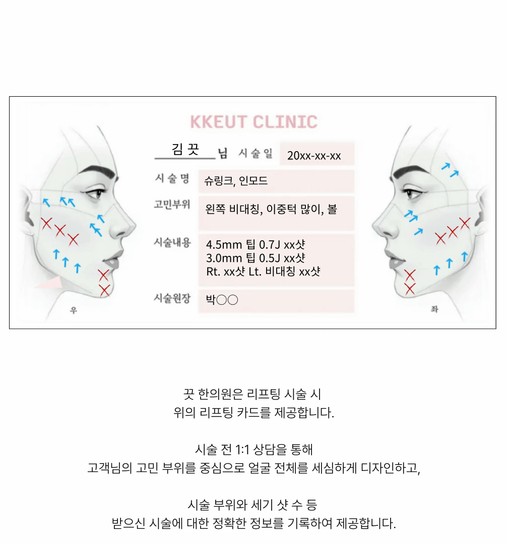  [피부 속부터 차오르는 탄력] 올리지오 리프팅 상세 이미지