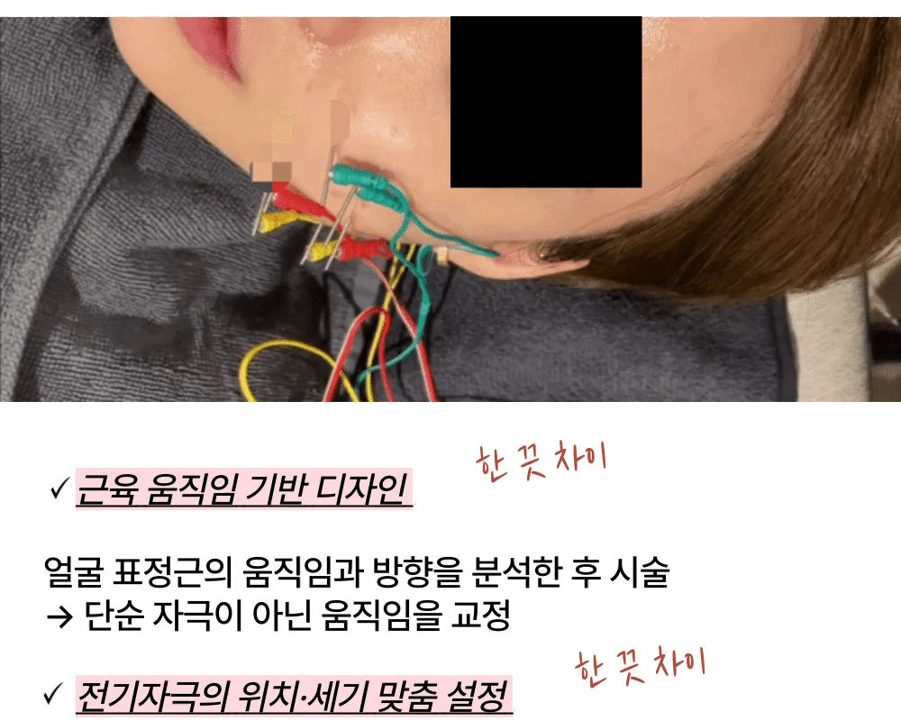 리프팅된 상태를 기억하는 [정안침]