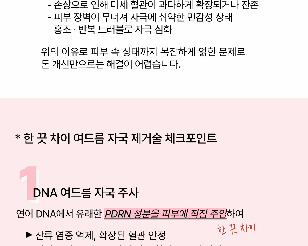 여드름 자국 제거술, 시간이 아니라 이 시술이 약입니다. 상세 이미지