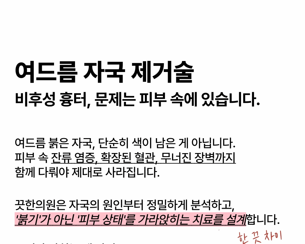 여드름 자국 제거술, 시간이 아니라 이 시술이 약입니다. 상세 이미지