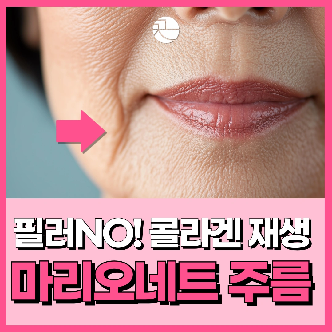 필러no!-마리오네트주름 콜라겐볼륨침 COVA