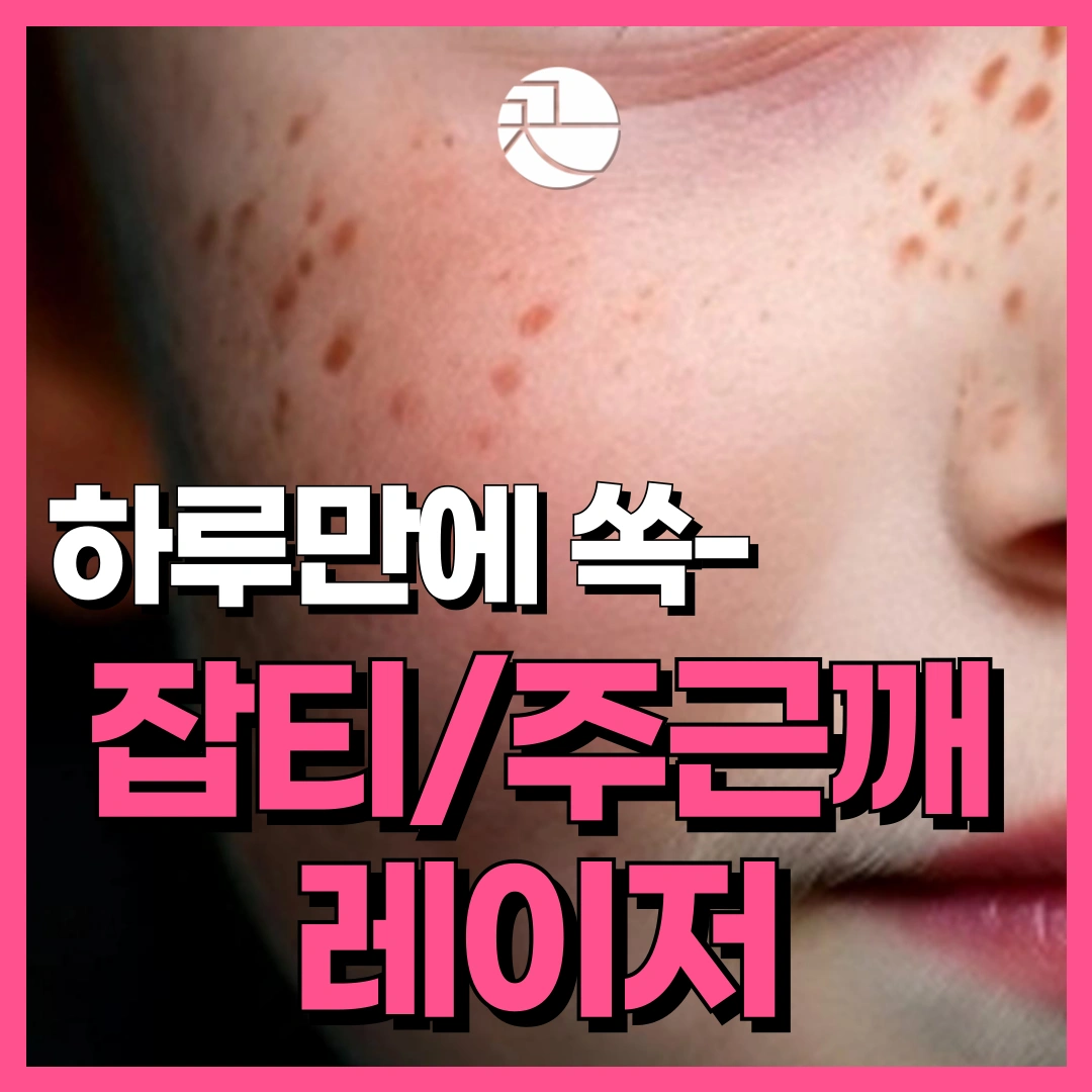 [하루만에 쏙 빼는] 잡티/주근깨 레이저