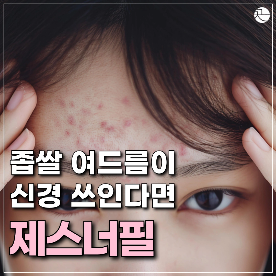 [좁쌀 여드름을 해결하는] 제스너필