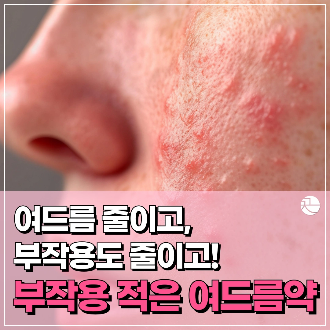 [염증 줄이고 붉은기 빼주는] 여드름 한약
