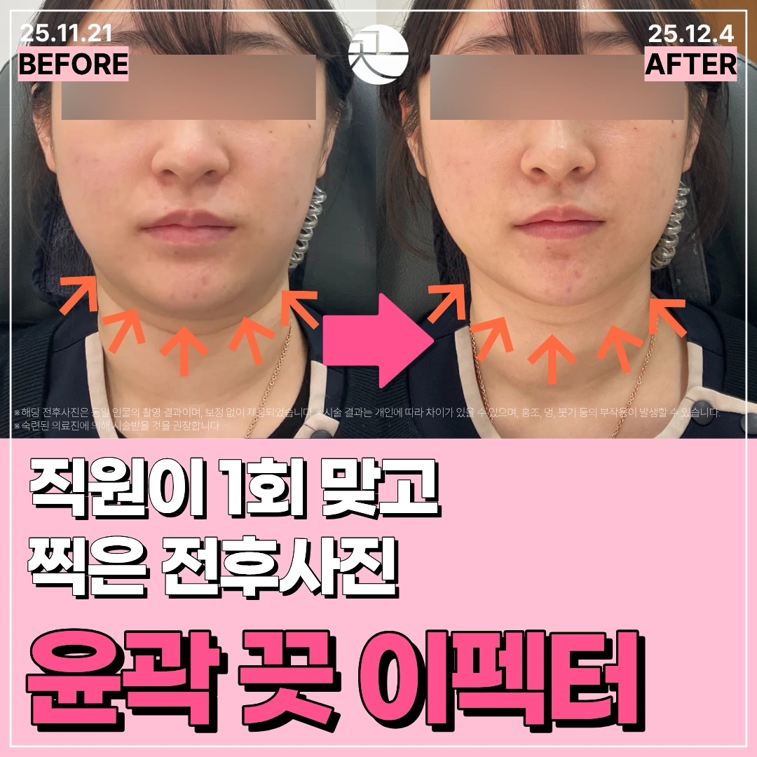 [직원 추천 윤곽 관리] 윤곽 끗 이펙터
