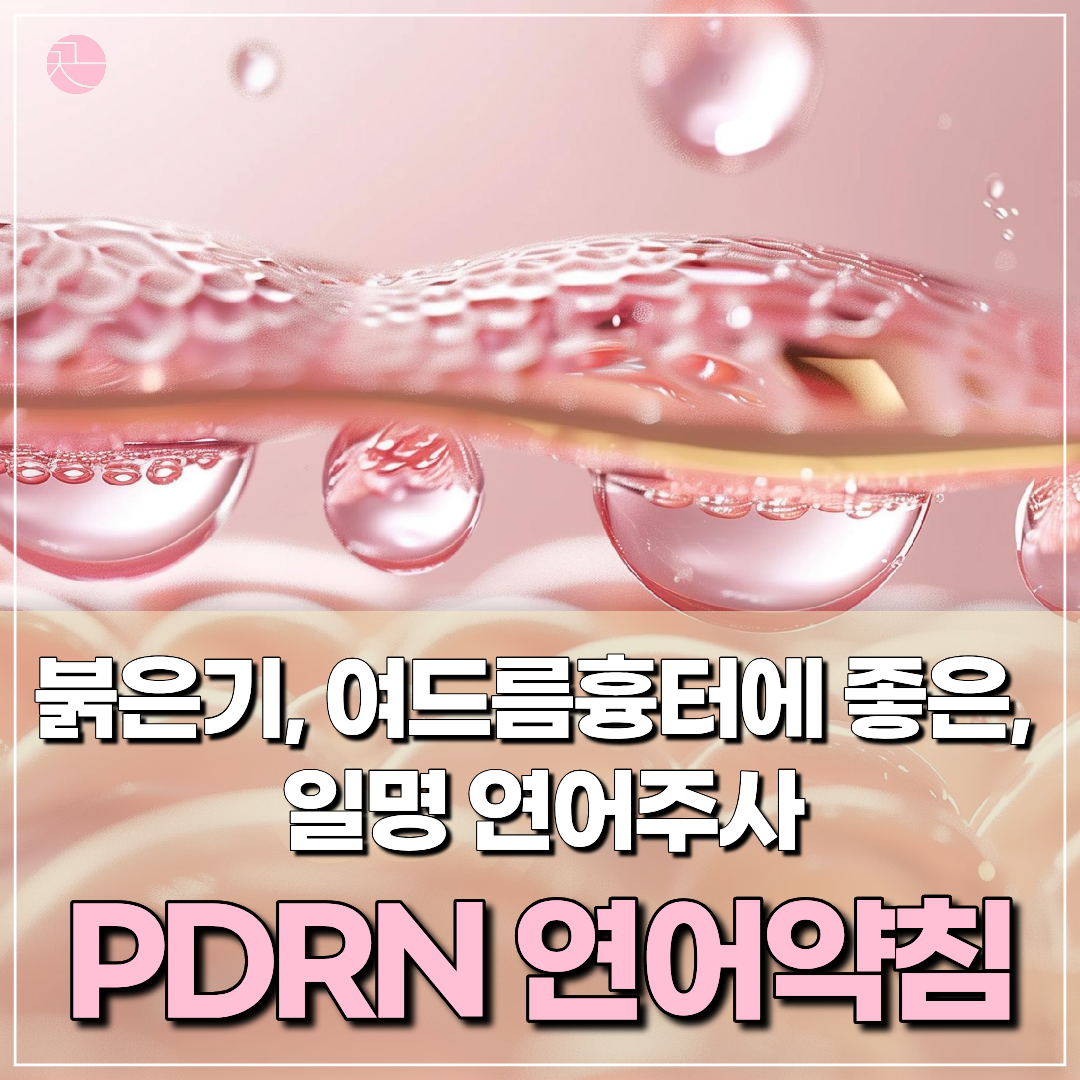 [붉은기, 여드름자국] PDRN 연어주사(약침)