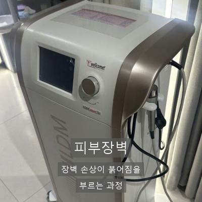 민감성피부, 붉어짐이 반복될 때 LDM이 필요한 이유 이미지 2