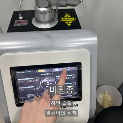 피부과비립종, 손으로 짜면 안 되는 이유와 제거 과정 이미지 1