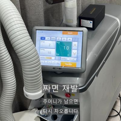 피부과비립종, 손으로 짜면 안 되는 이유와 제거 과정 이미지 3