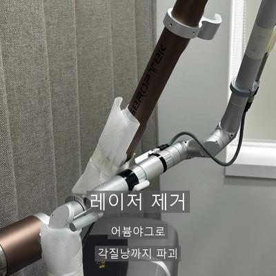 피부과비립종, 손으로 짜면 안 되는 이유와 제거 과정 이미지 5