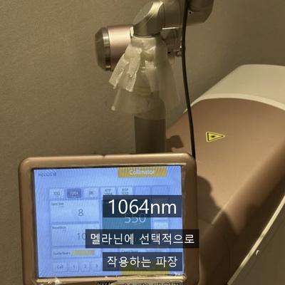 기미제거피부과, 토닝을 한 번에 끝내기 어려운 이유 이미지 2