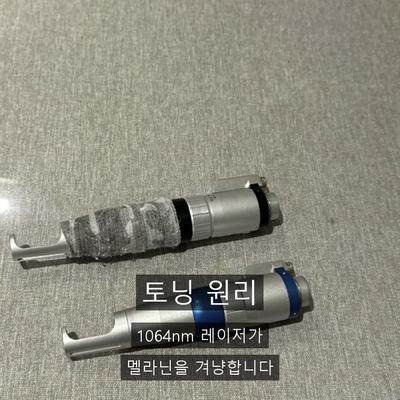 우주인토닝 찾으신다면? 레이저토닝 원리와 추천대상 정리 이미지 2