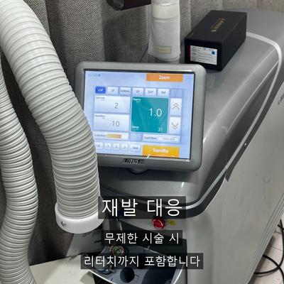 물사마귀치료, 번지기 전에 잡아야 하는 이유 이미지 8