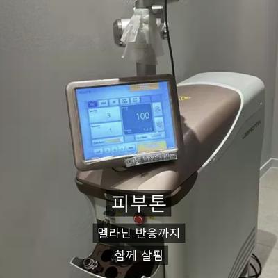 문신제거 치료기관을 고를 때 확인할 3가지 기준 이미지 3