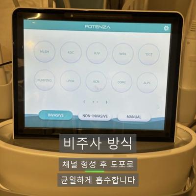 큐어젯쥬베룩 알아보신다면? 쥬베룩 원리와 추천대상 정리 이미지 7