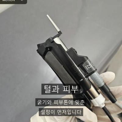 제모추천, 레이저제모 고를 때 체크해야 할 3가지 이미지 2