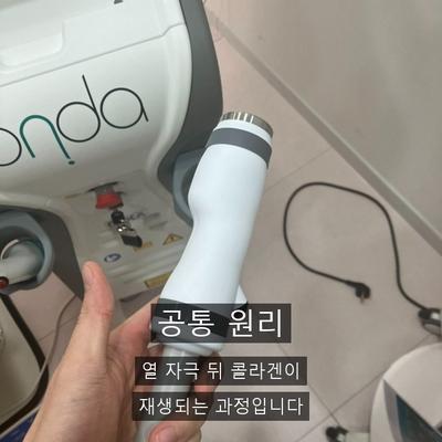 피부과리프팅 종류 총정리, 온다리프팅은 어디에 속할까? 이미지 2