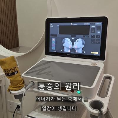 티타늄리프팅통증 걱정된다면? 리프팅 통증 원리와 울쎄라 정리 이미지 2