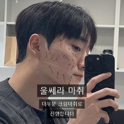 티타늄리프팅통증 걱정된다면? 리프팅 통증 원리와 울쎄라 정리 이미지 4