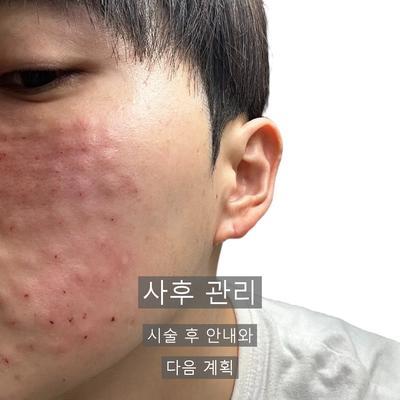 리쥬란 시술기관을 고를 때 확인할 기준 3가지 이미지 6