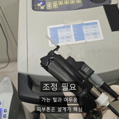 레이저제모 추천 대상은? 어떤 분들께 적합한지 총정리 이미지 4