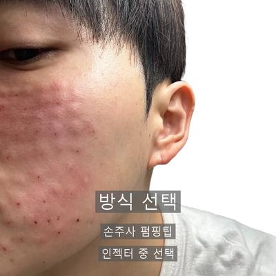 리쥬란 시술기관을 고를 때 확인할 3가지 기준 이미지 3