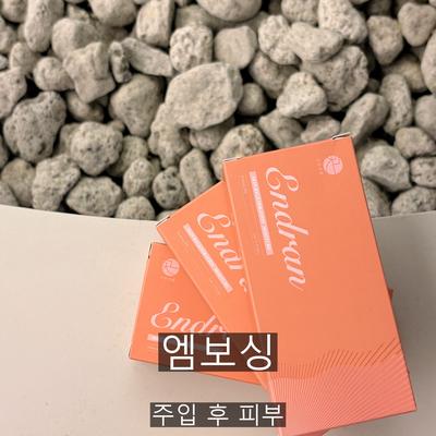 리쥬란 시술기관을 고를 때 확인할 3가지 기준 이미지 5