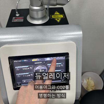 물사마귀없애는법, 집에서 안 되는 이유와 병원 치료의 차이 이미지 5